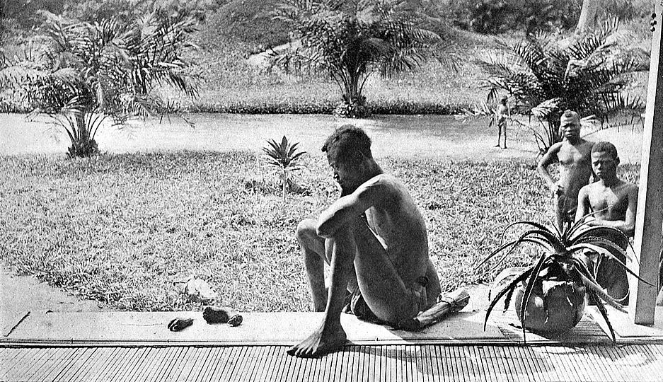 Historisches Foto: Die Kautschukgewinnung in den Kolonialgebieten war für die Bevölkerung vielfach mit fürchterlichen Gräueln verbunden: Ein Vater vor den abgehackten Gliedmaßen seines Kindes, Belgisch-Kongo 1904.