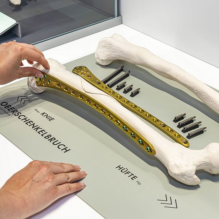 Knochenbruch Ausstellung Gesundheit