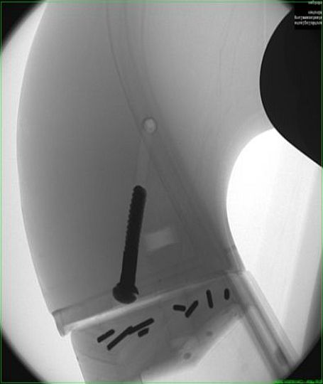 Foto of the examination of the harp with an X-ray machine